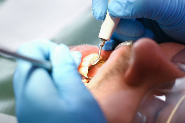 Best Emergency Dental Filling Replacement  in Scotland Neck, NC