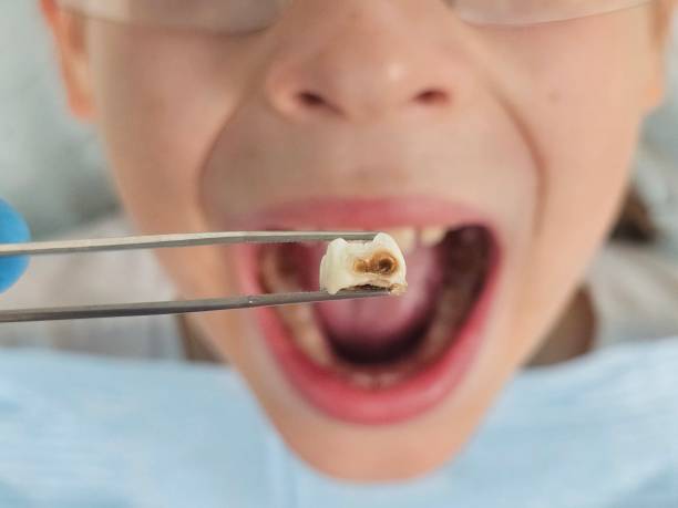 Best Chipped Tooth Repair Near Me  in Scotland Neck, NC