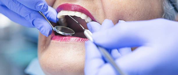 Emergency Dental Filling Replacement in NC
